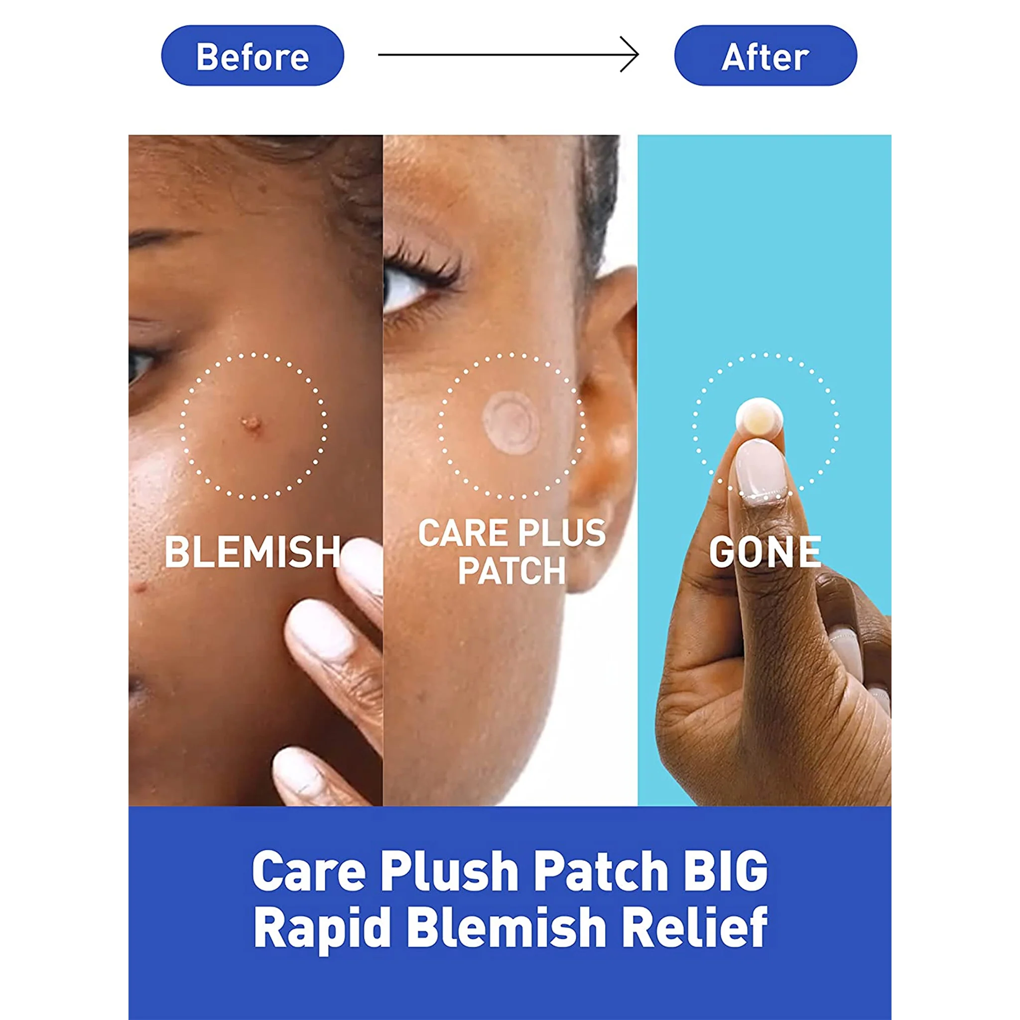 OLIVE YOUNG Care Plus Big Clear Patchs - Image 3