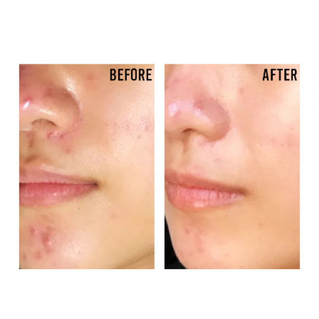 PURITO Centella Unscented Recovery Cream 50 ml - Image 5