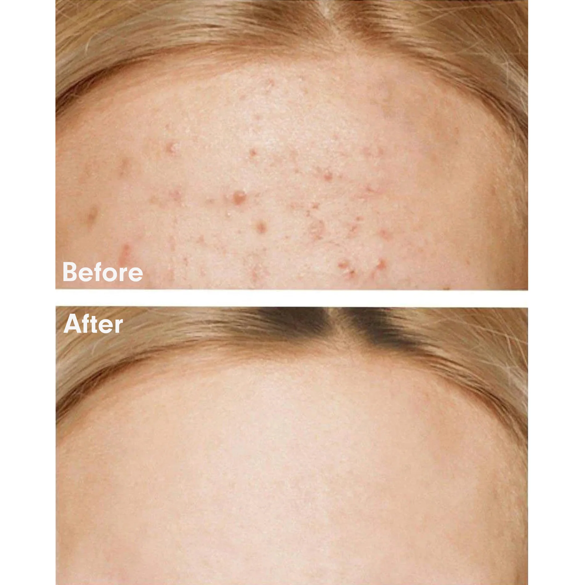 SOME BY MI 30 Days Miracle Cream 60 g - Image 4