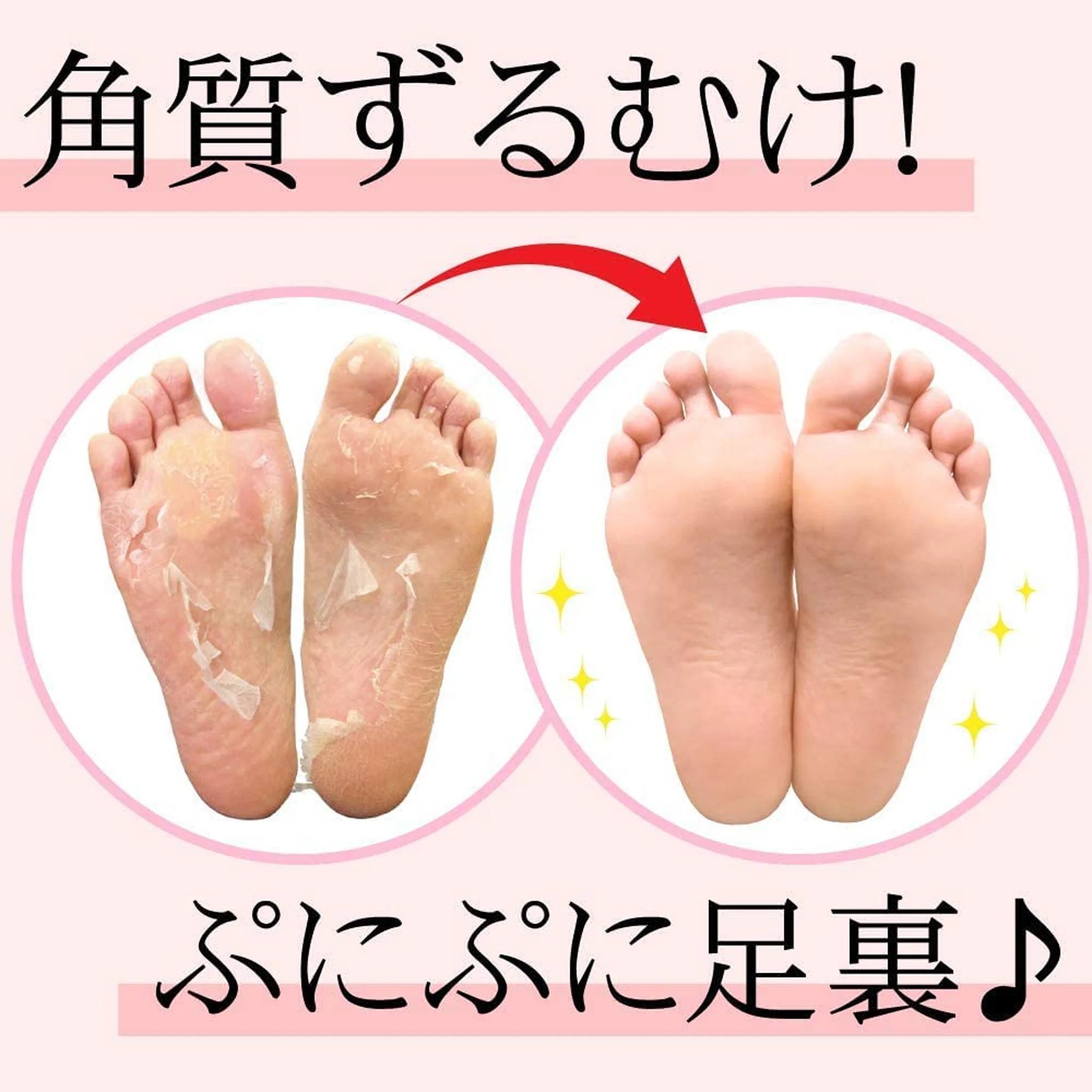 SOSU Foot Peeling Pack Perorin Emissions 2set - Image 3
